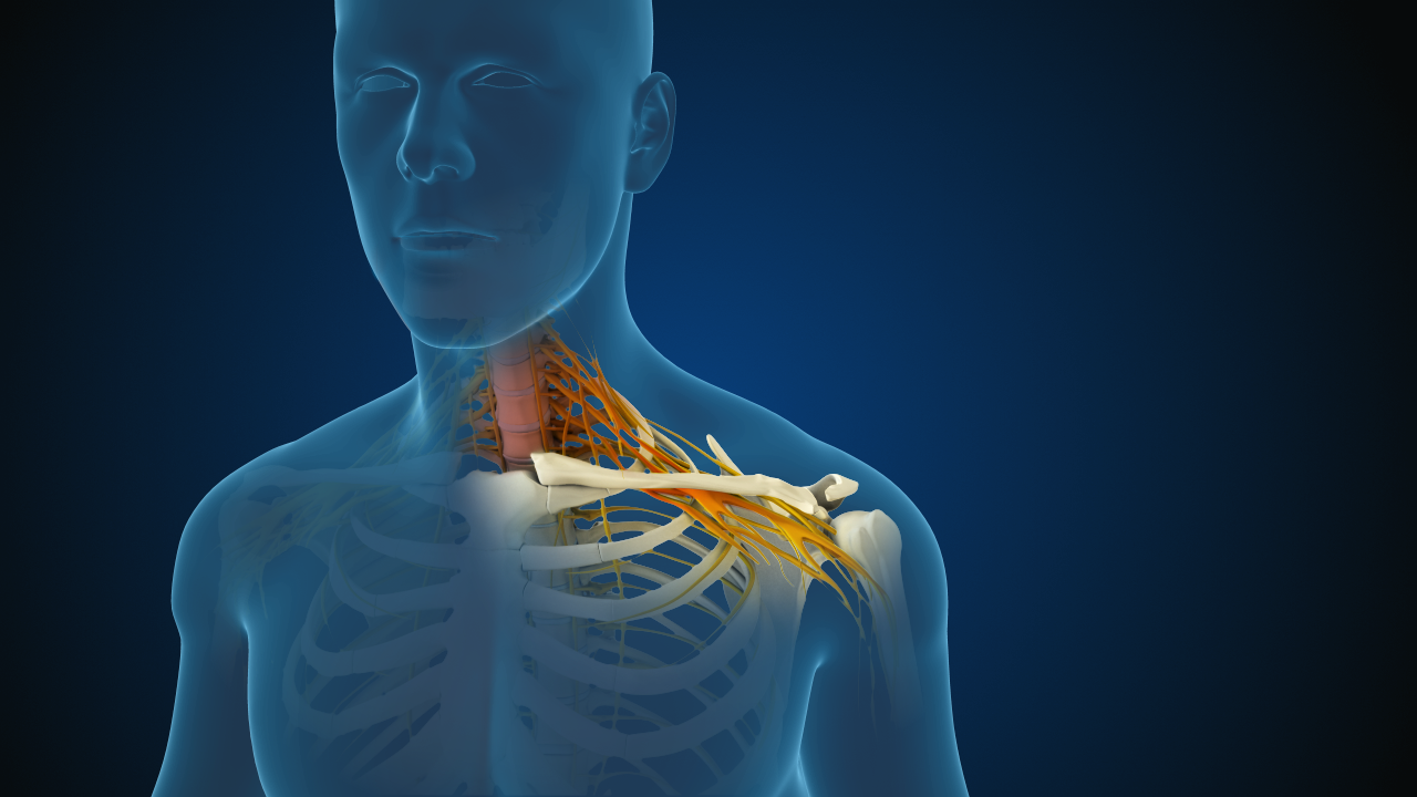 Cervical Radiculopathy/Myelopathy